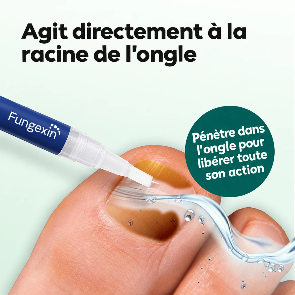 Le stylo Fungexin agit directement a la racine de l'ongle